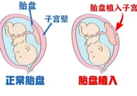 【多险叠加孕途艰 妙手仁心护周全】武宁县总医院人民医院院区成功救治高危胎盘植入产妇