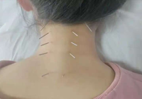 【健康科普】告别颈椎疼痛！康复疼痛科送您一份“颈椎自救指南”