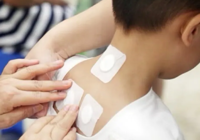 【中医技术】春季鼻炎发作—中医适宜技术让鼻子畅快呼吸