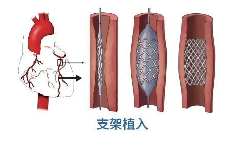 7fd50770adcd403e8d49e21e7dcb45c5.png