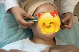 【中医特色疗法】“刮”出好气色！面部全息玉石刮痧—让您不动刀也能悄悄变美！