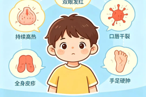 【健康科普】认识“川崎病”：宝宝持续高烧背后的“心脏隐形杀手”